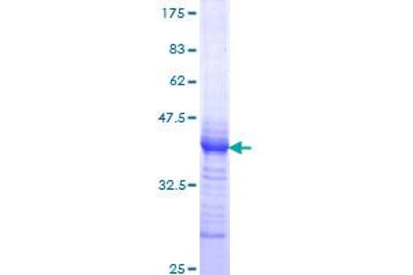 EGR1 Protein (AA 444-543) (GST tag)