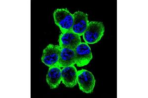 Confocal immunofluorescent analysis of MBP Antibody (Ascites) ABIN1539854 with NCI- cell followed by Alexa Fluor® 488-conjugated goat anti-mouse lgG (green). (MBP antibody)