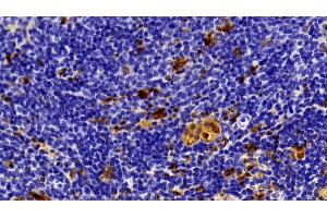 Detection of GAL3 in Rat Spleen Tissue using Polyclonal Antibody to Galectin 3 (GAL3) (Galectin 3 antibody  (AA 1-262))