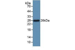 Detection of Recombinant Bcl2L, Rat using Monoclonal Antibody to B-Cell CLL/Lymphoma 2 Like Protein (Bcl2L) (BCL2L1 antibody  (AA 2-212))