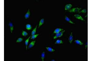 Immunofluorescent analysis of Hela cells using ABIN7170239 at dilution of 1:100 and Alexa Fluor 488-congugated AffiniPure Goat Anti-Rabbit IgG(H+L) (SLC35F6 antibody  (AA 337-371))