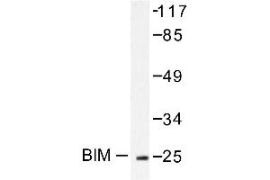 Image no. 1 for anti-BCL2-Like 11 (Apoptosis Facilitator) (BCL2L11) antibody (ABIN265330) (BIM antibody)
