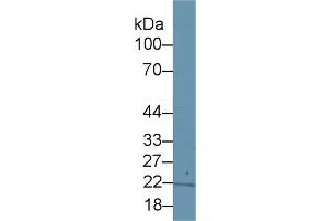 Western Blot; Sample: Human Lung lysate; Primary Ab: 1µg/ml Rabbit Anti-Human ITPA Antibody Second Ab: 0. (ITPA antibody  (AA 3-180))