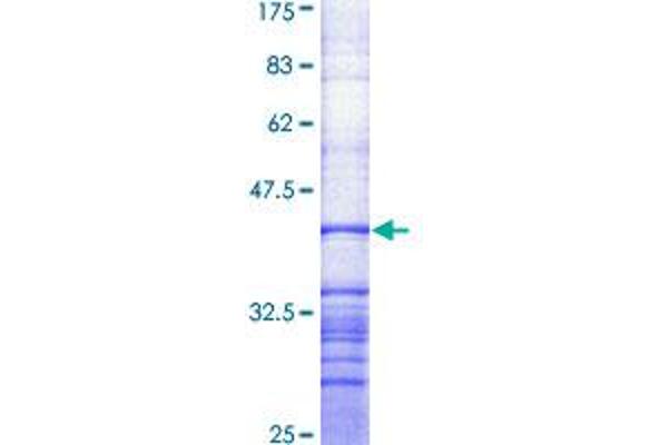 ABCA1 Protein (AA 86-185) (GST tag)