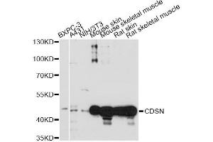 Western blot analysis of extracts of various cell lines, using CDSN antibody (ABIN6294198) at 1:1000 dilution.