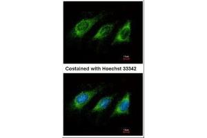 ICC/IF Image Immunofluorescence analysis of methanol-fixed HeLa, using AICDA, antibody at 1:500 dilution. (AICDA antibody  (N-Term))