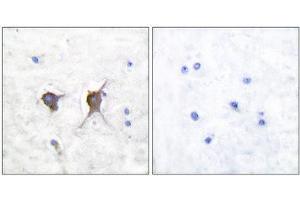 Immunohistochemistry (IHC) image for anti-BCL2-Associated X Protein (BAX) (N-Term) antibody (ABIN1848439) (BAX antibody  (N-Term))