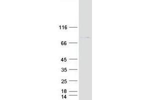 ACCN4 Protein (Transcript Variant 2) (Myc-DYKDDDDK Tag)