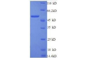 SDS-PAGE (SDS) image for Cathepsin B (CTSB) (AA 82-333), (partial) protein (GST tag) (ABIN1046771)