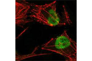 Confocal immunofluorescence analysis of HeLa cells using MSH2 monoclonal antibody, clone 1B3 (3A2B8C)  (green), showing nuclear localization. (MSH2 antibody)