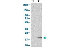 Western Blot analysis of (1) Negative control (vector only transfected HEK293T lysate), and (2) Over-expression lysate (Co-expressed with a C-terminal myc-DDK tag (~3. (GnRH2 antibody)