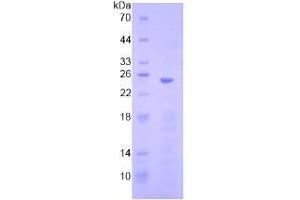 SDS-PAGE analysis of Human HMG1 Protein.