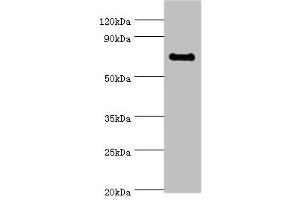 Western blot All lanes: TAF5L antibody at 10 μg/mL + Jurkat whole cell lysate Secondary Goat polyclonal to rabbit IgG at 1/10000 dilution Predicted band size: 67, 37 kDa Observed band size: 67 kDa (TAF5L antibody  (AA 1-325))