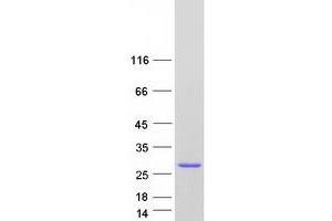Validation with Western Blot