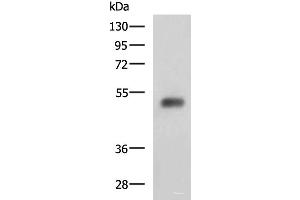 Western blot analysis of Human bladder transitional cell carcinoma grade 2-3 tissue lysate using SLC30A6 Polyclonal Antibody at dilution of 1:2000 (SLC30A6 antibody)