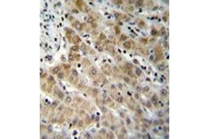 Formalin fixed and paraffin embedded human liver tissue reacted with Endothelin-1 Antibody (C-term) followed by peroxidase conjugation of the secondary antibody and DAB staining. (Endothelin 1 antibody  (C-Term))
