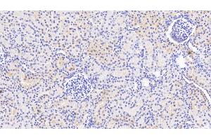 Detection of PTPN13 in Human Kidney Tissue using Polyclonal Antibody to Protein Tyrosine Phosphatase, Non Receptor Type 13 (PTPN13) (PTPN13 antibody  (AA 1-161))