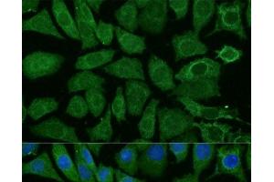 Immunofluorescence analysis of L929 cells using NDUFB4 Polyclonal Antibody at dilution of 1:100 (40x lens). (NDUFB4 antibody)