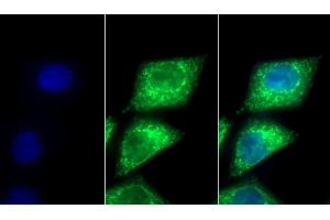 Detection of PDHA1 in Human HepG2 cell using Polyclonal Antibody to Pyruvate dehydrogenase alpha 1 (PDHA1) (PDHA1 antibody  (AA 30-390))
