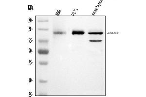 Western blot analysis of Daxx using anti-Daxx antibody (ABIN3043822). (DAXX antibody  (AA 56-345))