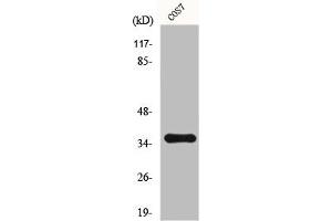 Western Blot analysis of 293 cells using Fos B Polyclonal Antibody (FOSB antibody)