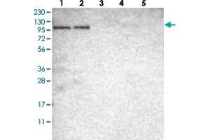 Western blot analysis of Lane 1: RT-4, Lane 2: U-251 MG, Lane 3: Human Plasma, Lane 4: Liver, Lane 5: Tonsil with SGEF polyclonal antibody . (SGEF antibody)