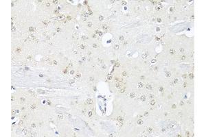Immunohistochemistry of paraffin-embedded mouse brain using RBFOX3 antibody (ABIN1874561) at dilution of 1:100 (40x lens). (NeuN antibody)