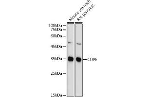 Western blot analysis of extracts of various cell lines, using COPE antibody (ABIN6133492, ABIN6138873, ABIN6138874 and ABIN6214159) at 1:1000 dilution. (COPE antibody  (AA 1-308))