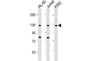 All lanes : Anti-ATP2A3 Antibody (N-Term) at 1:2000 dilution Lane 1: HL-60 whole cell lysate Lane 2: Jurkat whole cell lysate Lane 3: K562 whole cell lysate Lysates/proteins at 20 μg per lane. (ATP2A3 antibody  (AA 13-47))