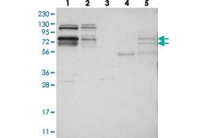 Western blot analysis of Lane 1: RT-4, Lane 2: U-251 MG, Lane 3: Human Plasma, Lane 4: Liver, Lane 5: Tonsil with RBM28 polyclonal antibody  at 1:250-1:500 dilution.