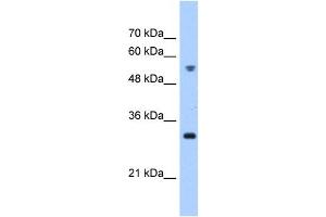 TTC5 antibody used at 0. (TTC5 antibody  (C-Term))