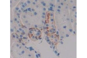 Figure. (HMGCR antibody  (AA 638-887))