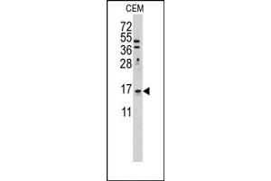 Image no. 1 for anti-LSM1 Homolog, U6 Small Nuclear RNA Associated (LSM1) (C-Term) antibody (ABIN358046) (LSM1 antibody  (C-Term))