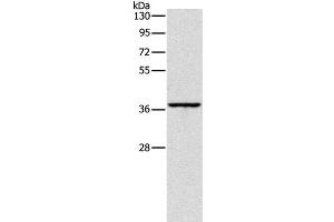 Western Blot analysis of Huvec cell using APOL2 Polyclonal Antibody at dilution of 1:375