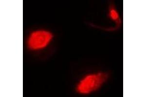 Immunofluorescent analysis of SUFU staining in MCF7 cells. (SUFUH antibody)