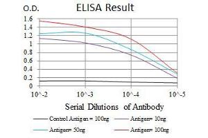 Black line: Control Antigen (100 ng), Purple line: Antigen(10 ng), Blue line: Antigen (50 ng), Red line: Antigen (100 ng), (Cytokeratin 5 antibody  (AA 316-590))