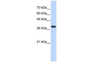 ATP4B antibody used at 1 ug/ml to detect target protein. (ATP4b antibody  (Middle Region))