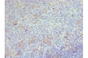 Immunohistochemistry of paraffin-embedded human tonsil tissue using ABIN7158900 at dilution of 1:100 (CD68 antibody  (AA 22-319))