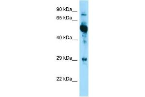 WB Suggested Anti-KRT6A Antibody Titration: 1. (KRT6A antibody  (Middle Region))