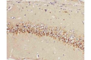 Anti-5HT1A Receptor antibody, IHC(P): Rat Brain Tissue (Serotonin Receptor 1A antibody  (C-Term))