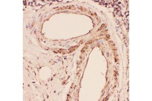 Immunohistochemistry (IHC) image for anti-Desmin (DES) (AA 1-304) antibody (ABIN3043265)