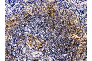 Immunohistochemistry (Paraffin-embedded Sections) (IHC (p)) image for anti-Actin, alpha 1, Skeletal Muscle (ACTA1) (AA 277-308), (C-Term) antibody (ABIN3043519) (Actin antibody  (C-Term))