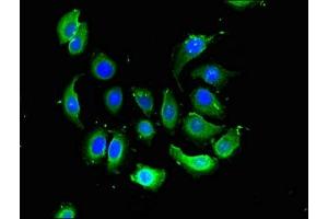 Immunofluorescent analysis of A549 cells using ABIN7175192 at dilution of 1:100 and Alexa Fluor 488-congugated AffiniPure Goat Anti-Rabbit IgG(H+L) (VSIG4 antibody  (AA 20-283))