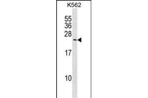 MYL6B Antibody (Center) (ABIN1538709 and ABIN2850105) western blot analysis in K562 cell line lysates (35 μg/lane). (MYL6B antibody  (AA 96-123))