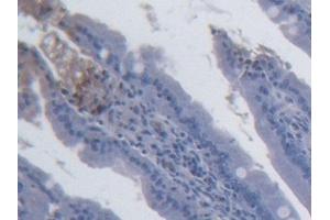 Detection of IL15 in Rat Small intestine Tissue using Monoclonal Antibody to Interleukin 15 (IL15) (IL-15 antibody  (AA 49-162))