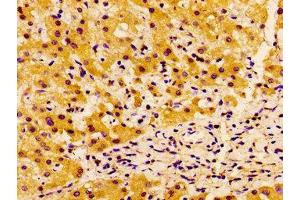 Immunohistochemistry (IHC) image for anti-Synovial Sarcoma, X Breakpoint 2 Interacting Protein (SSX2IP) (AA 485-614) antibody (ABIN7143574)