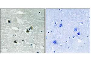 Immunohistochemistry analysis of paraffin-embedded human brain tissue using MER/SKY (Phospho-Tyr749/681) antibody. (MER/SKY (pTyr681), (pTyr749) antibody)