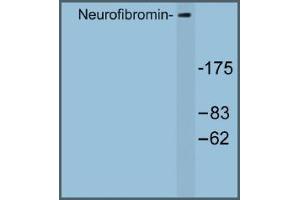 Image no. 1 for anti-Neurofibromin 1 (NF1) antibody (ABIN317682)