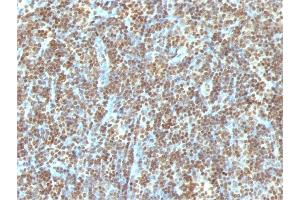 Formalin-fixed, paraffin-embedded human Tonsil stained with Double Stranded DNA Mouse Monoclonal Antibody (121-3) (dsDNA antibody)