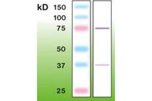 Image no. 1 for anti-Protein Kinase C, beta (PRKCB) antibody (ABIN342479) (PKC beta antibody)